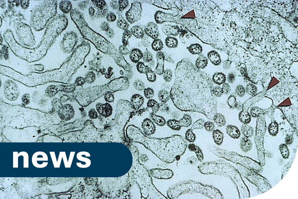 Lassa fever contact tracing underway